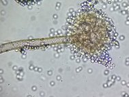 Aspergillus flavus под микроскопом