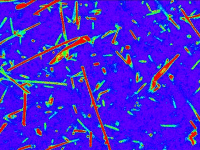 Изображение бактерий, полученное при помощи нового метода. Предоставлено авторами исследования