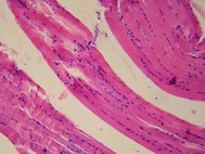Мышечная ткань под микроскопом