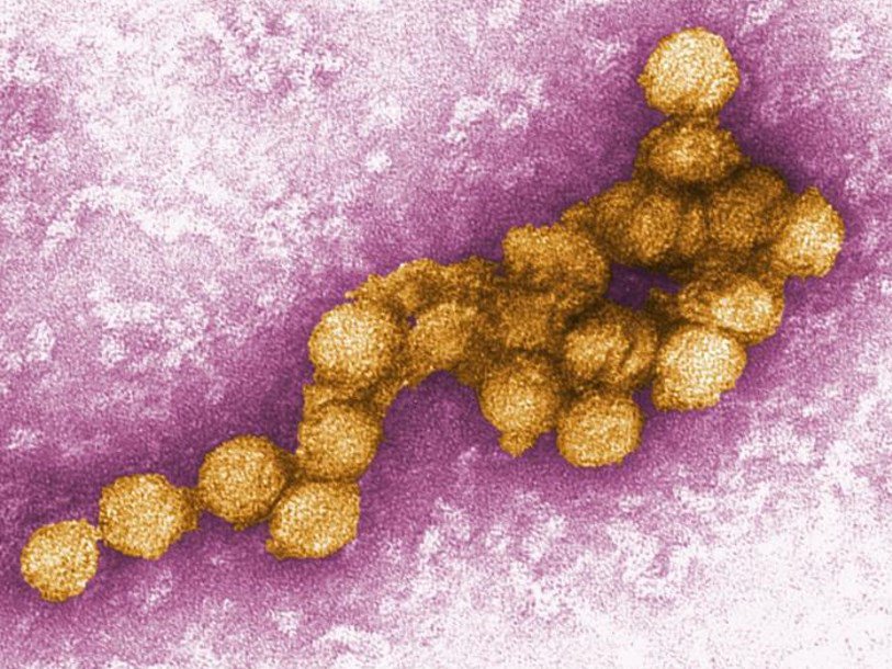 Вирус лихорадки Западного Нила