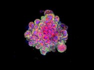 Мини-плацента под микроскопом. Разные белки окрашены разными цветами