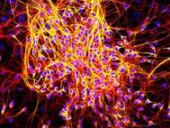Нейроны, выращенные в культуре. Антитела к тау-белку обозначены красным и желтым