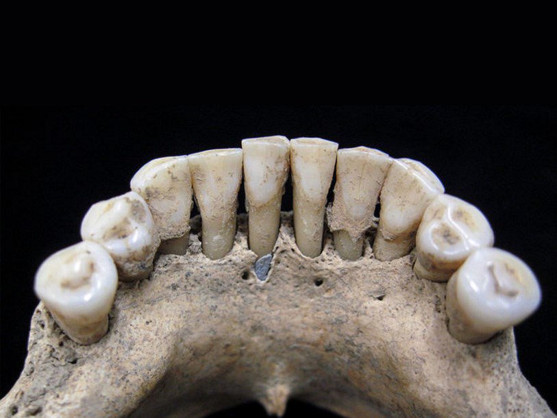 Частицы лазуритовой краски видны под пятым зубом слева
