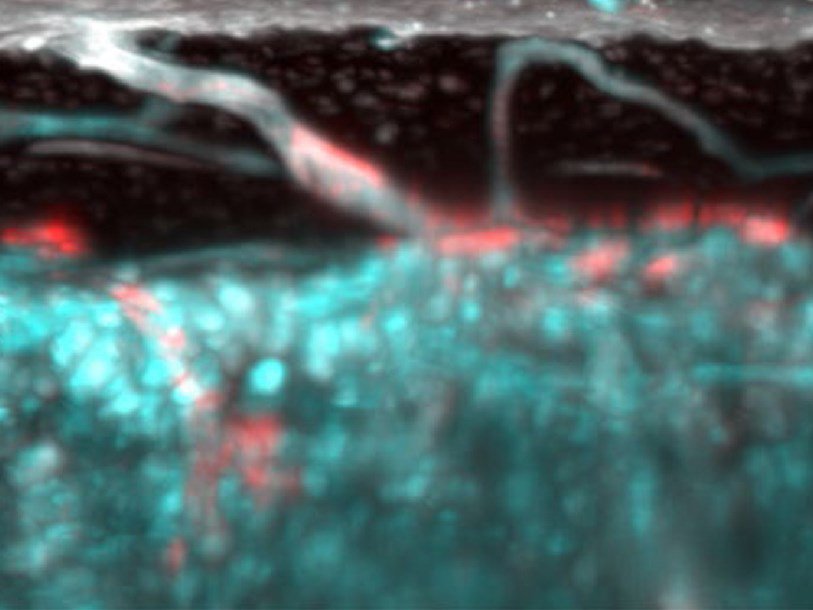 Изучая под микроскопом большие берцовые кости мышей, ученые обнаружили множество мелких каналов