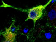 Нервная клетки мыши с частично поврежденными аксонами (обозначены зеленым)