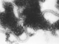 Респираторно-синцитиальный вирус под микроскопом