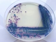 Культуры Escherichia coli и Klebsiella pneumoniae на посеве мочи пациента