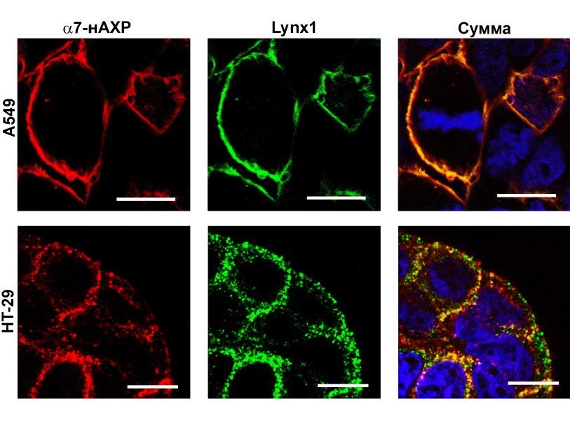 Солокализация белка Lynx1 (зелёный цвет) и α7-нАХР (красный цвет) в клетках рака лёгкого (A549) и прямой кишки (HT-29). Синим цветом выделены ядра клеток. Масштаб шкалы 10 мкм