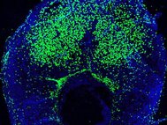 Распределение клеток костного мозга, отмеченных зеленым флуоресцентным белком, в матке мыши