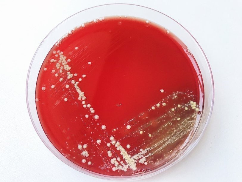 Колонии бактерий на кровяном агаре