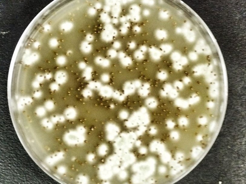 Колонии Cryptococcus gattii в чашке Петри