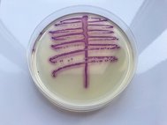 E. coli в чашке Петри