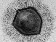 Мимивирус, один из самых больших вирусов