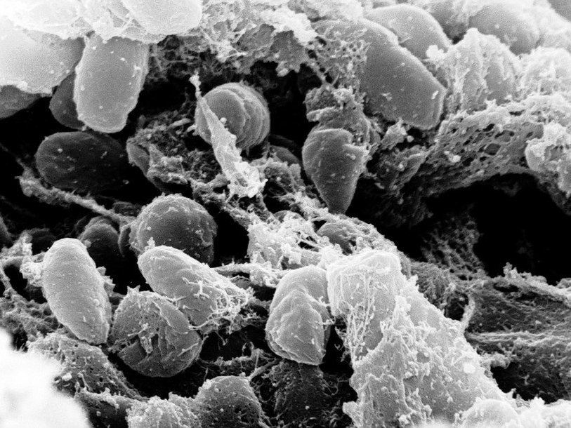 Бактерии Yersinia pestis под электронным микроскопом