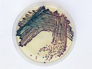Klebsiella pneumoniae и Escherichia coli в чашке Петри