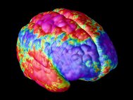 Скан мозга человека с шизофренией
