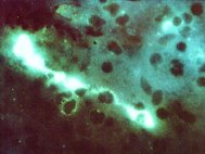 Бактерии Chlamydophila psittaci под микроскопом