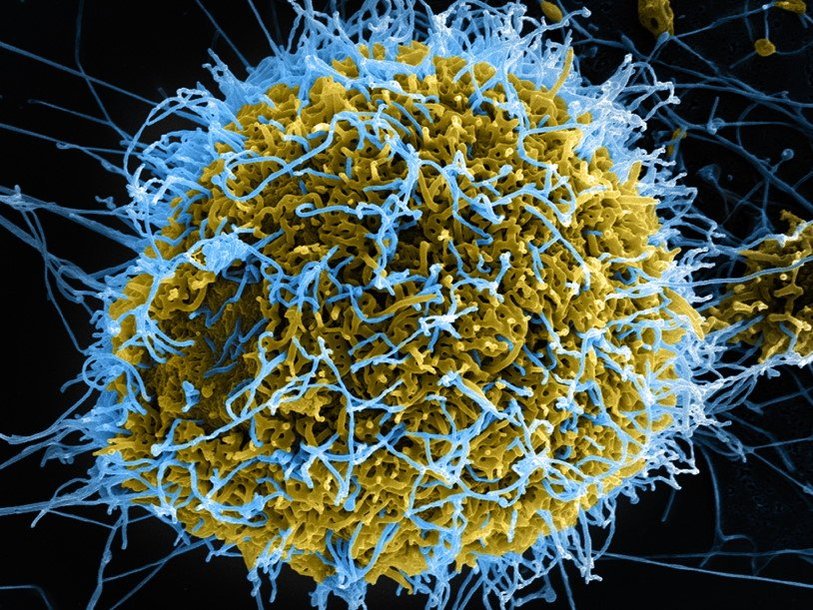 Частицы вируса Эбола под электронным микроскопом