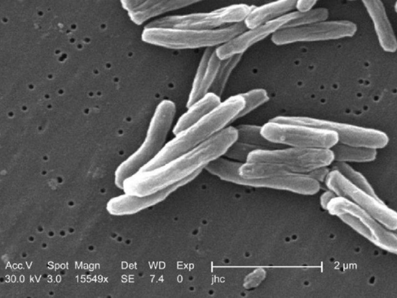 Mycobacterium tuberculosis, возбудитель туберкулеза