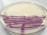 Колония бактерий рода Клебсиелла