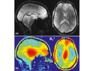 Изображение головного мозга волонтера и распределение радиочастотного магнитного поля, полученные с помощью разработанной фазированной решетки