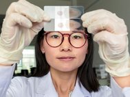 Лаборантка Юньнаньского института паразитарных заболеваний с образцами крови, содержащими возбудителей малярии, 2019 год