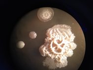 Колонии почвенных микроорганизмов