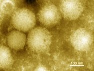 Вирусные частицы YEZV под электронным микроскопом