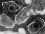 Частицы вируса Эпштейна — Барр под электронным микроскопом