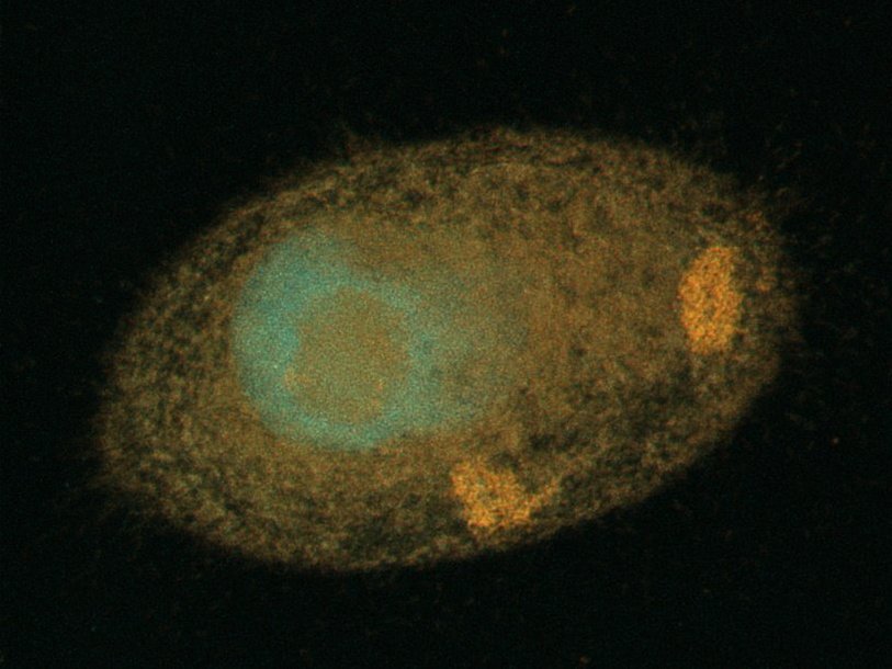 Изображение инфузории с симбионтами, полученное методом конфокальной микроскопии