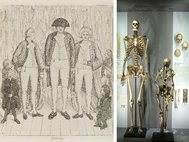 Чарльз Бирн, гравюра 1794 года и скелет в музее