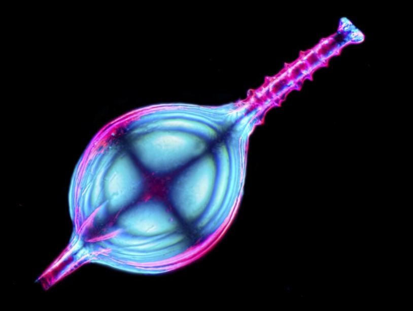 Wellcome Image Awards 2014: механическое сердце, челюсть IX века и многое другое
