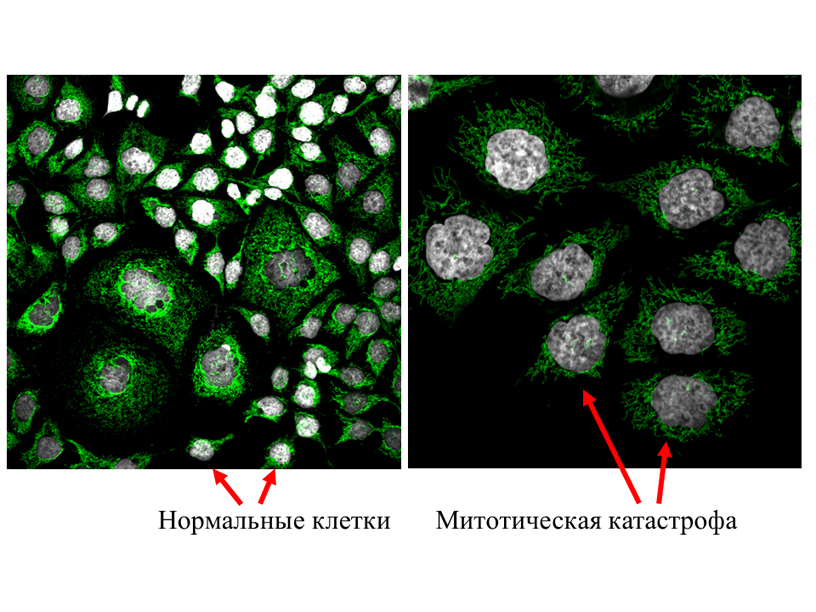 Найден новый способ уничтожения опухолевых клеток