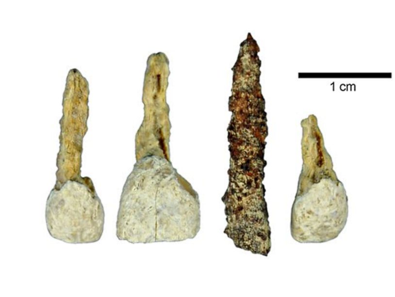 Археологи нашли вставной зуб возрастом 2300 лет