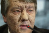 Ющенко знает происхождение яда, которым был отравлен