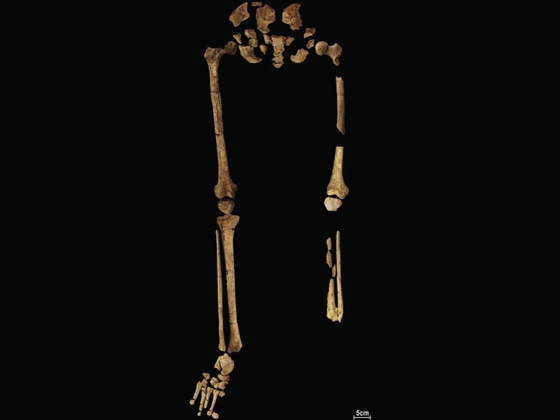Самая древняя ампутация была проведена на Калимантане 31 000 лет назад