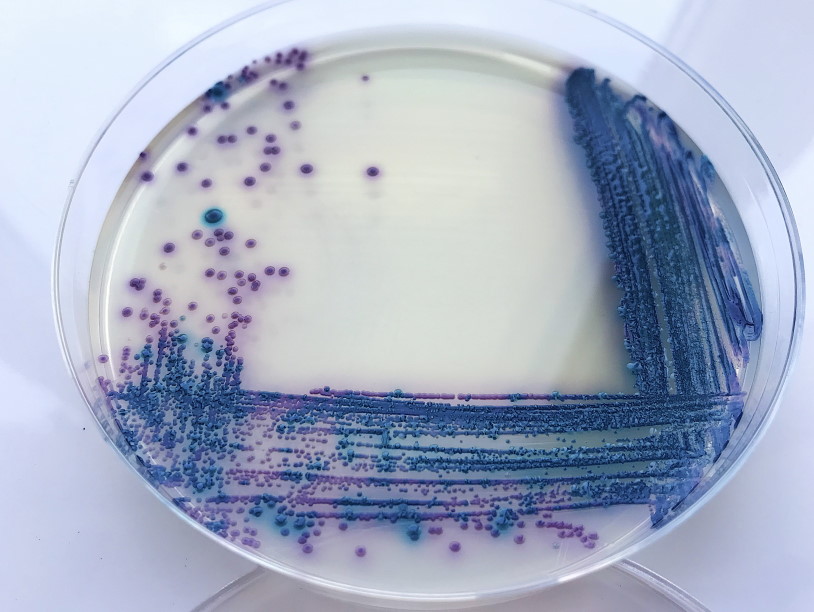 Промикробы: Моча, окутанная мифами